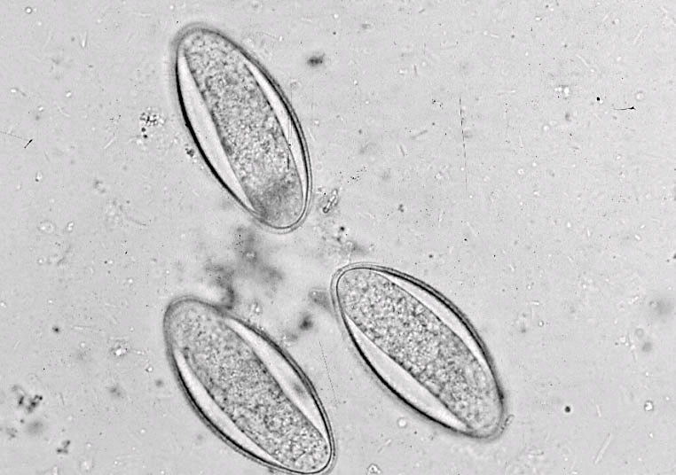 Aspiculuris eggs