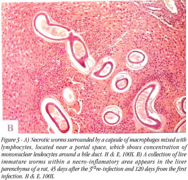 Capillaria hepatic in rat liver