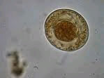 Hymenolepis egg (tapeworm)