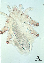 Myocoptes musculinis