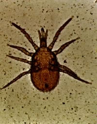 Ornithonyssus bacoti
