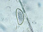 Rabbit pinworm eggs (Passalurus ambiguus)