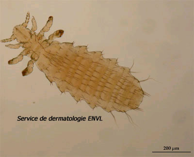 Rat louse, Polyplax spinulosa