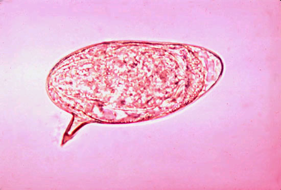 Schistosoma mansoni