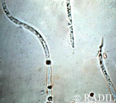Rat bladder worm, Trichosomoides crassicauda
