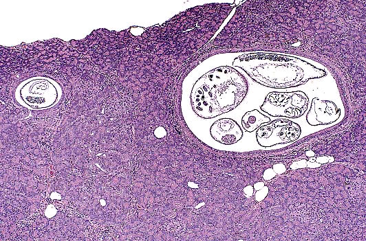 Trichospirura leptostoma in a marmoset pancreas