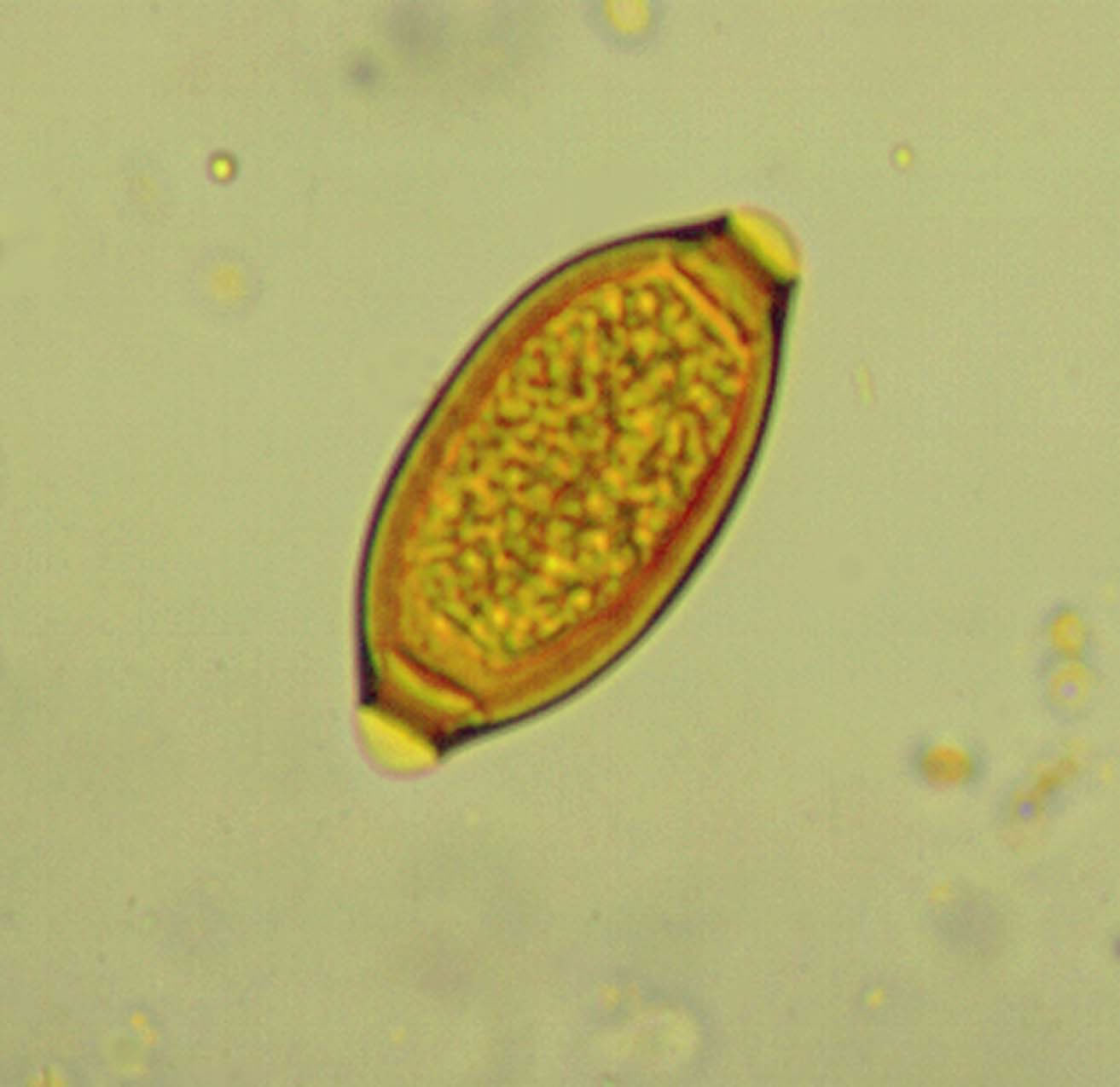 Whipworm egg (Trichuris)